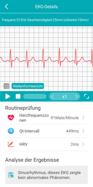 Screenshot der Kardena CARE Pro 4 Plus App mit EKG-Analyse, Herzfrequenz und HRV-Auswertung.